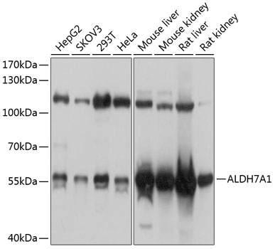 ALDH7A1 Rabbit Polyclonal Antibody