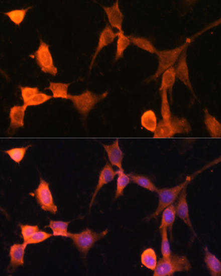CACYBP Rabbit Polyclonal Antibody