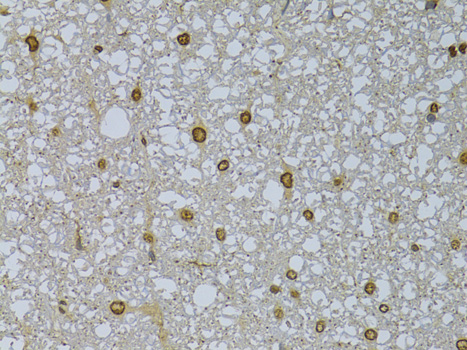 HDGFRP3 Polyclonal Antibody