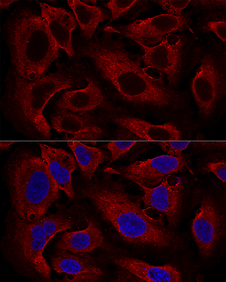 ARL8B Polyclonal Antibody
