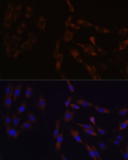 SUCLG2 Polyclonal Antibody