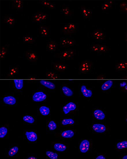 EBNA1BP2 Polyclonal Antibody