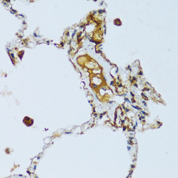 C1QC Rabbit Polyclonal Antibody