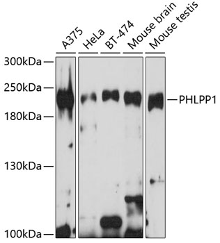 PHLPP1 Rabbit Polyclonal Antibody