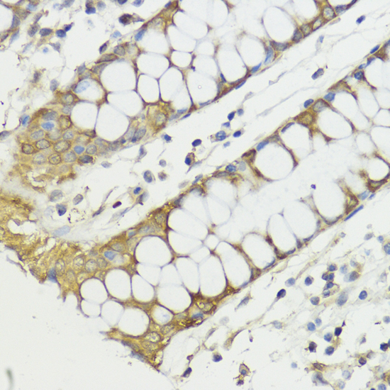 HACE1 Rabbit Polyclonal Antibody