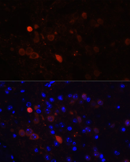 CALB2 Rabbit Polyclonal Antibody