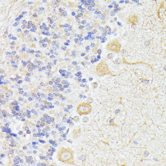ELP3 Polyclonal Antibody