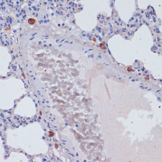 PRF1 Antibody