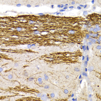 NEFL antibody