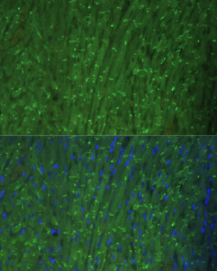 DES antibody