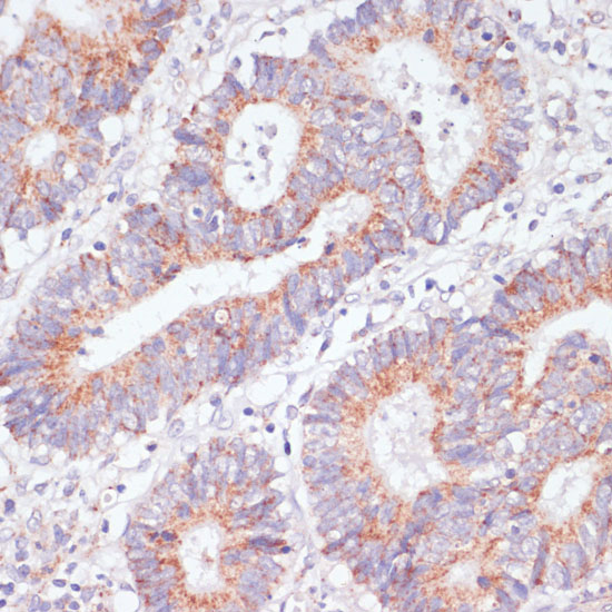 RAP1A antibody