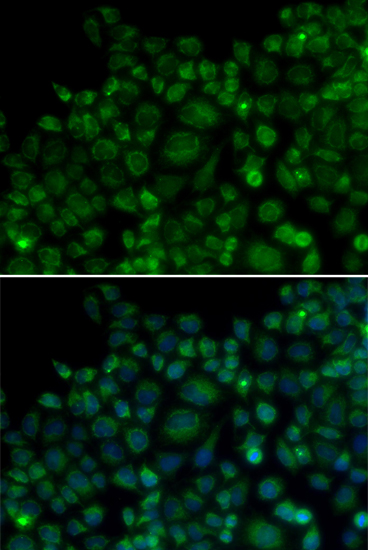 TLR7 antibody