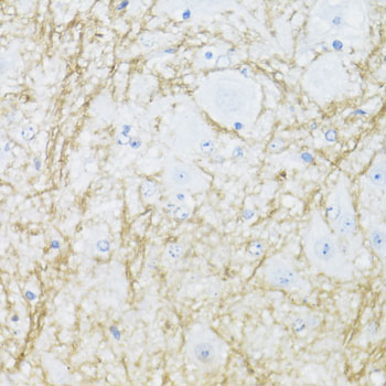 CNP antibody