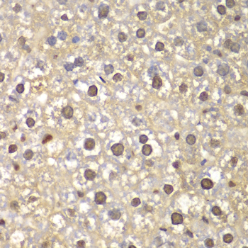 FEN1 Antibody