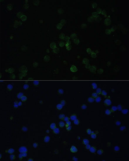 CD3D antibody