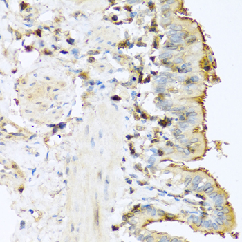 PRSS1 antibody