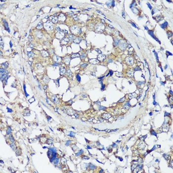 VAMP2 antibody