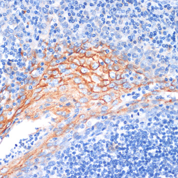 DBI Polyclonal Antibody
