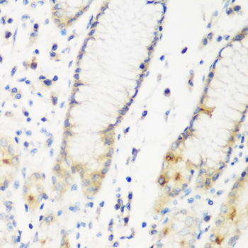 DHODH Polyclonal Antibody