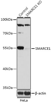 SMARCE1 Polyclonal Antibody