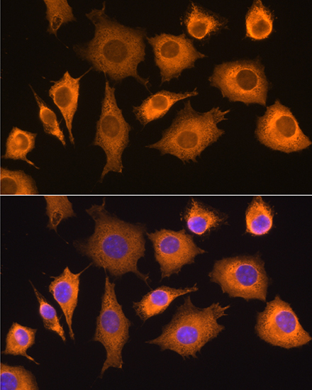 RIG-I / DDX58 Polyclonal Antibody