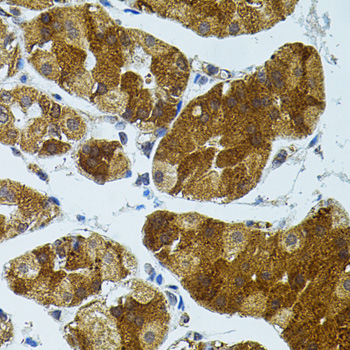 CETP antibody