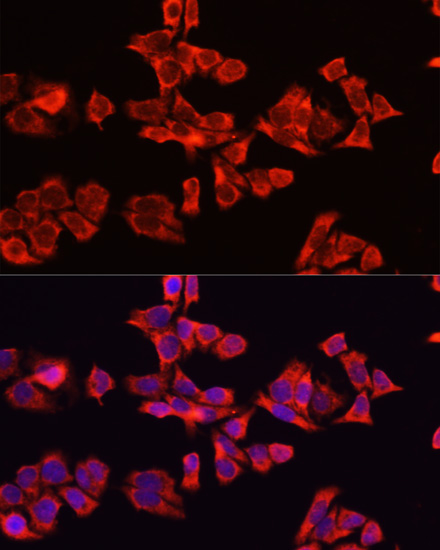 ALB antibody