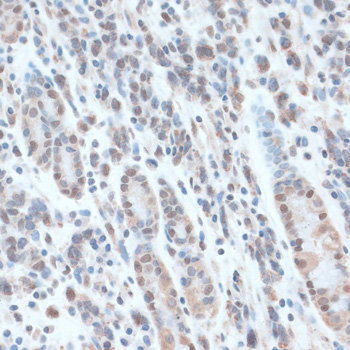 ZNF707 Polyclonal Antibody