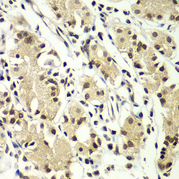 ZNF264 Polyclonal Antibody