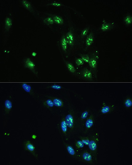 CCDC59 Polyclonal Antibody