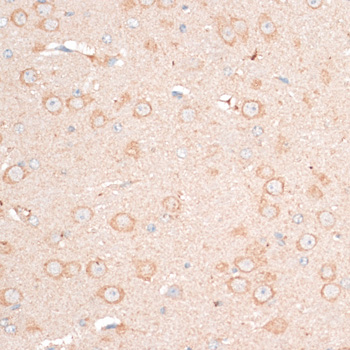 CDH18 Polyclonal Antibody