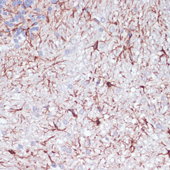 GFAP Antibody