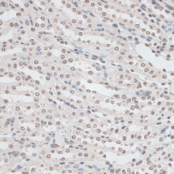 ZNF177 Polyclonal Antibody