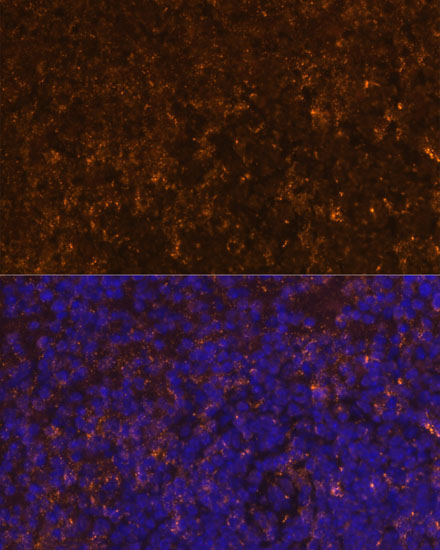 KLRC4 Polyclonal Antibody
