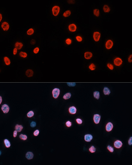 CDKN1A Antibody