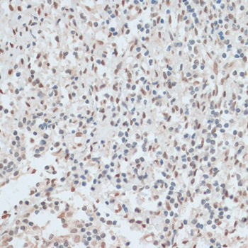 ZNF574 Polyclonal Antibody