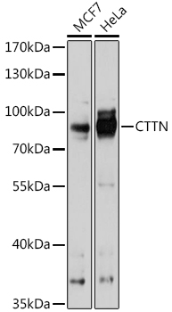CTTN Polyclonal Antibody