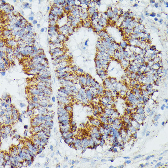 IVD Polyclonal Antibody