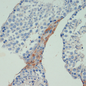 KIF5B Polyclonal Antibody