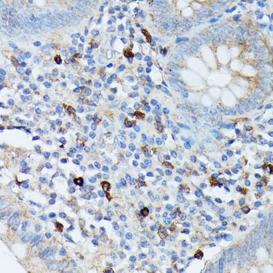 RNASE6 Polyclonal Antibody