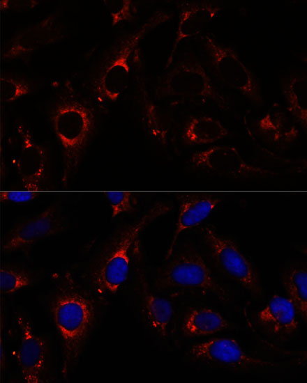 RNF112 Polyclonal Antibody
