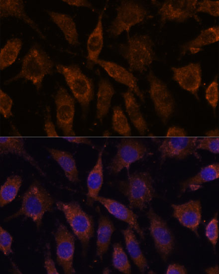 SUCLG1 Polyclonal Antibody