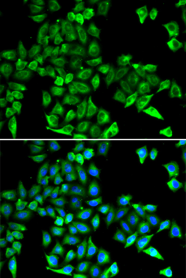 CST3 antibody