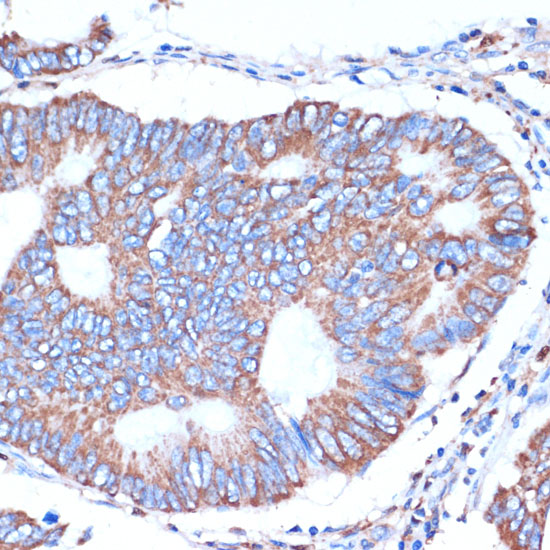 ITCH Polyclonal Antibody