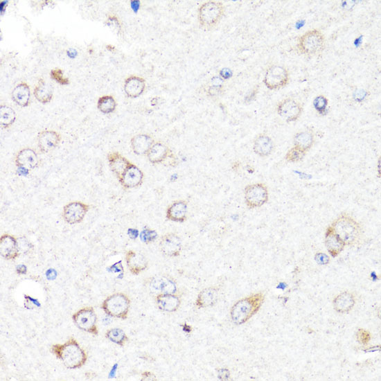 RNF149 Polyclonal Antibody