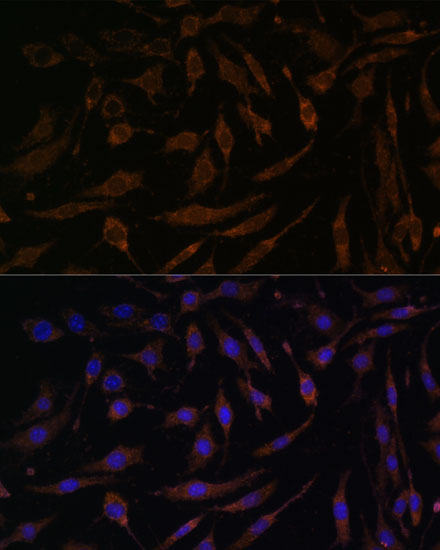 P90RSK Polyclonal Antibody