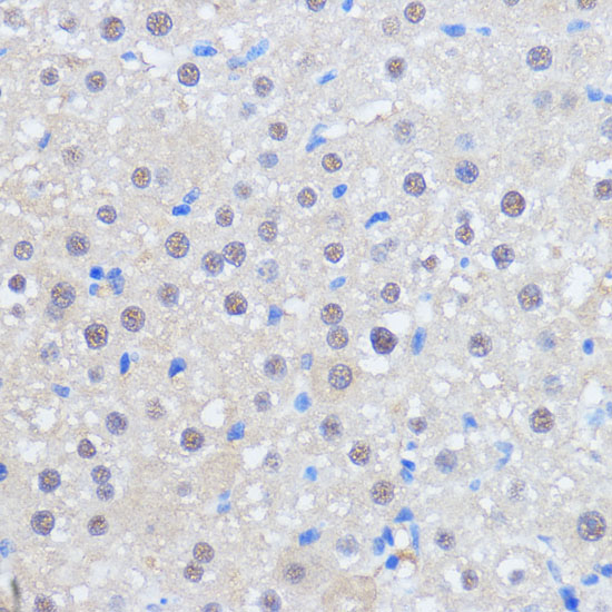 RBM39 Polyclonal Antibody