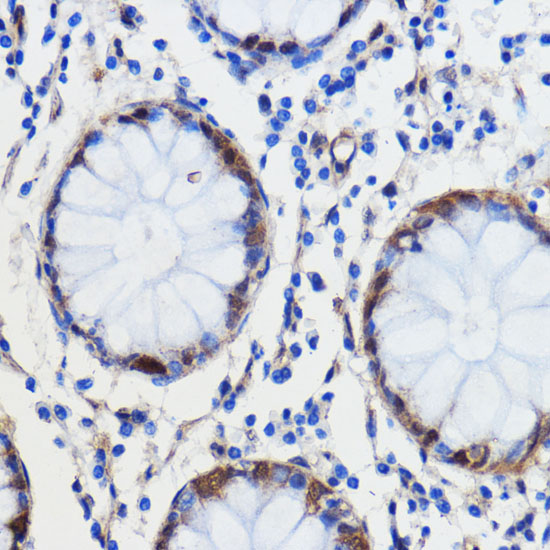 GCAT Polyclonal Antibody