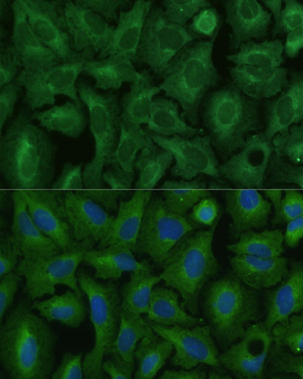 TIMM8B Polyclonal Antibody