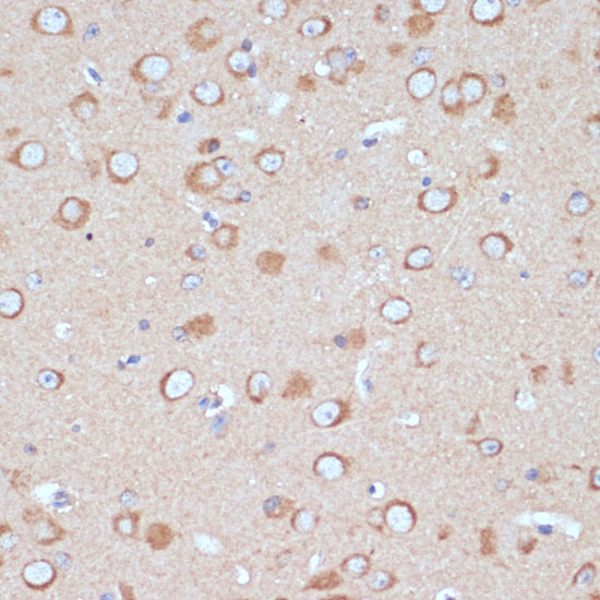 COPG2 Polyclonal Antibody